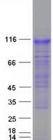 Human RNF157 Protein (Recombinant Myc-DDK (Flag))