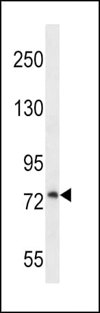 PLOD / PLOD1 Antibody (aa66-94)