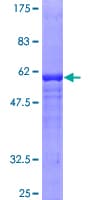 Human GDAP1 Protein (Recombinant GST)