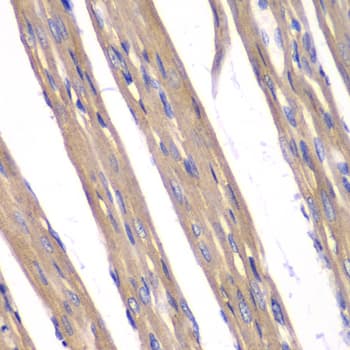 FXN / Frataxin Antibody