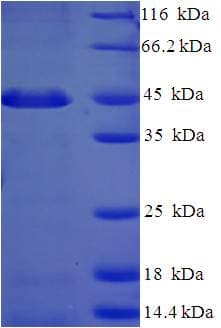 Human PSMF1 Protein (Recombinant His-SUMO)