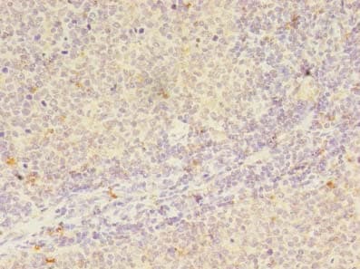 PPEF / PPEF1 Antibody