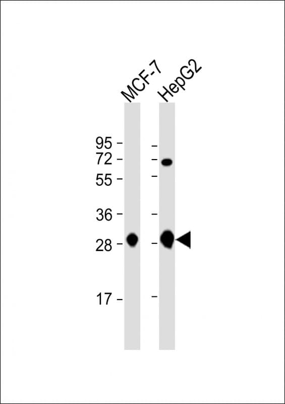 ECI1 / DCI Antibody (C-Terminus)