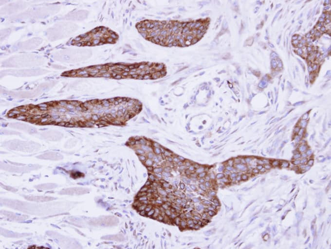 Polyclonal Rabbit anti-Human MLYCD / MCD Antibody (aa90-304, IHC, WB)