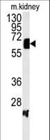 Polyclonal Rabbit anti-Human ATP6V1H Antibody (aa400-426, WB)