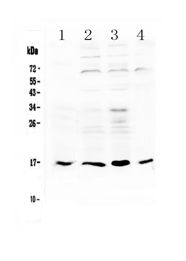 Polyclonal Rabbit anti-Human IL17B Antibody (WB)