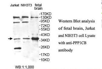 Polyclonal Rabbit anti-Human PPP1CB Antibody (aa30-319, IHC, WB)