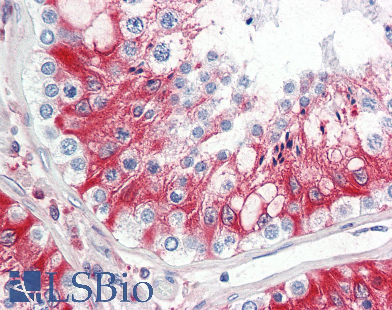 IHC-plus™ LHCGR / LHR / LH Receptor Antibody (aa622-699)