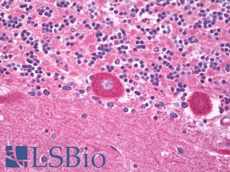 IHC-plus™ TRPV3 Antibody (aa662-692)