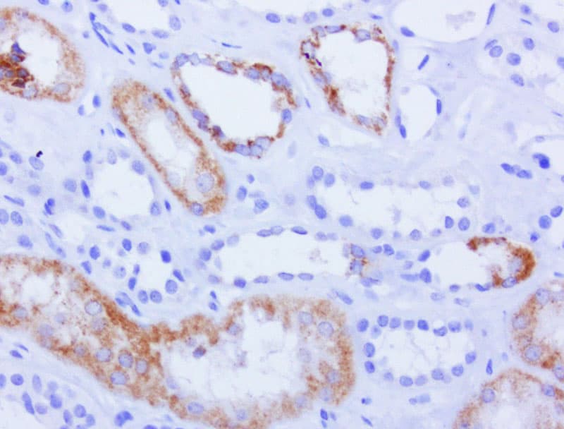Monoclonal Mouse anti-Human AMACR / P504S Antibody (clone UMAB68, IHC, IF)