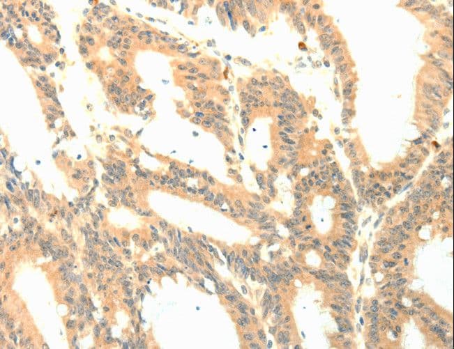 Polyclonal Rabbit anti-Human PTGES3 / p23 Antibody (IHC)