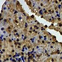 Polyclonal Rabbit anti-Human BSND / Barttin Antibody (IHC, WB)