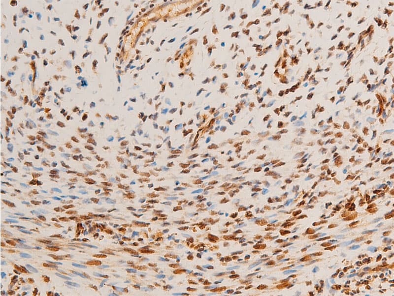 JUN / c-Jun Antibody (phospho-Thr93)
