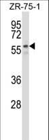 Polyclonal Rabbit anti-Human PUF60 Antibody (aa15-43, WB)