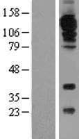 Human PECAM-1 / CD31 Protein (Over-Expression Lysate Myc-DDK (Flag))