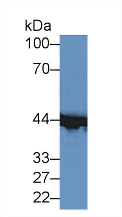 CKM / Creatine Kinase MM Antibody (aa11-367, APC)