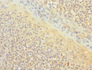 CD1C Antibody