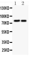 JUP/CTNNG/Junction Plakoglobin Antibody (aa101-118)