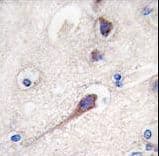 Polyclonal Rabbit anti-Human HPCA / Hippocalcin Antibody (aa2-32, IHC, WB)