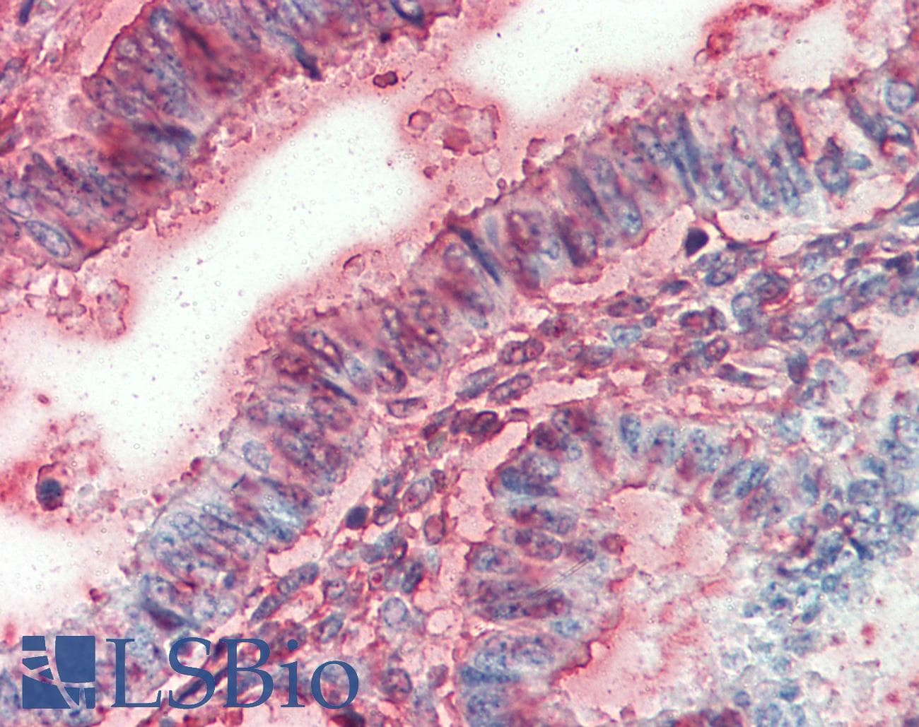 IHC-plus™ Polyclonal Rabbit anti-Human SLC12A2 / NKCC1 Antibody (Internal, IHC)