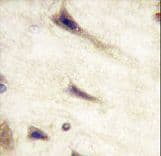 EPHA5 / EPH Receptor A5 Antibody (clone 46CT61.6.4)