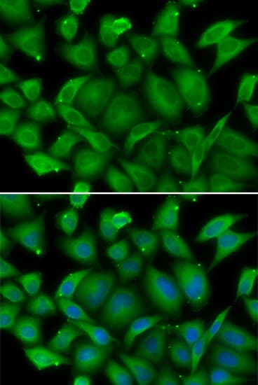 IHC-plus™ DEFA1 / Defensin Alpha 1 Antibody