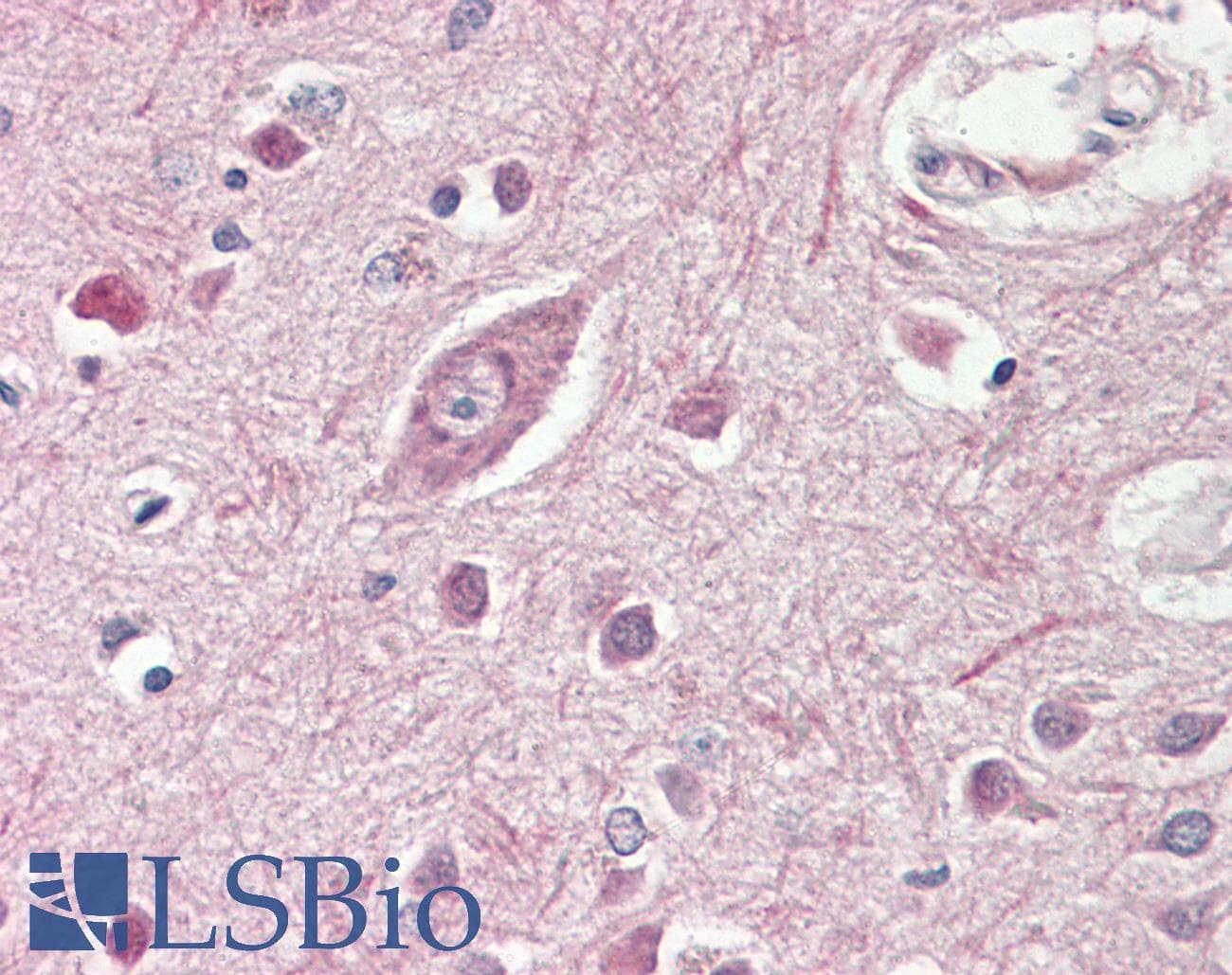 IHC-plus™ GRM2 / MGLUR2 Antibody (aa915-924)