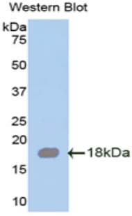 SRGN / Serglycin Antibody (aa28-152)