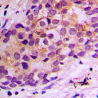 BAX Antibody (N-Terminus)