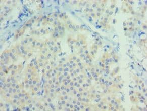 Polyclonal Rabbit anti-Human NTF3 / Neurotrophin 3 Antibody (aa19-257, IHC)