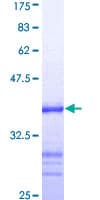 Human ATRX Protein (Recombinant GST, N-terminus)