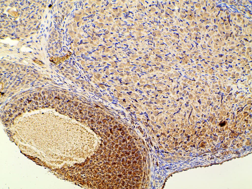 PIK3R1 / p85 Alpha Antibody (phospho-Tyr607)