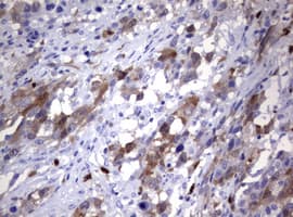 Monoclonal Mouse anti-Human TS / Thymidylate Synthase Antibody (clone OTI1B1, IHC, WB)