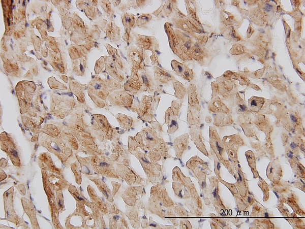 DAP-5 / EIF4G2 Antibody (clone 3B5)