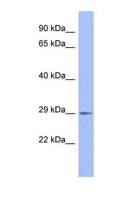EMG1 / NEP1 Antibody (C-Terminus)