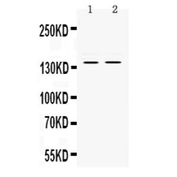 Polyclonal Rabbit anti-Human RENT1 / UPF1 Antibody (aa578-614, IHC, WB)