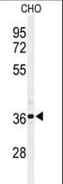 SIRT3 / Sirtuin 3 Antibody (aa304-334)