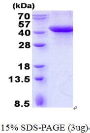 Human SPFH2 / ERLIN2 Protein (Recombinant His)