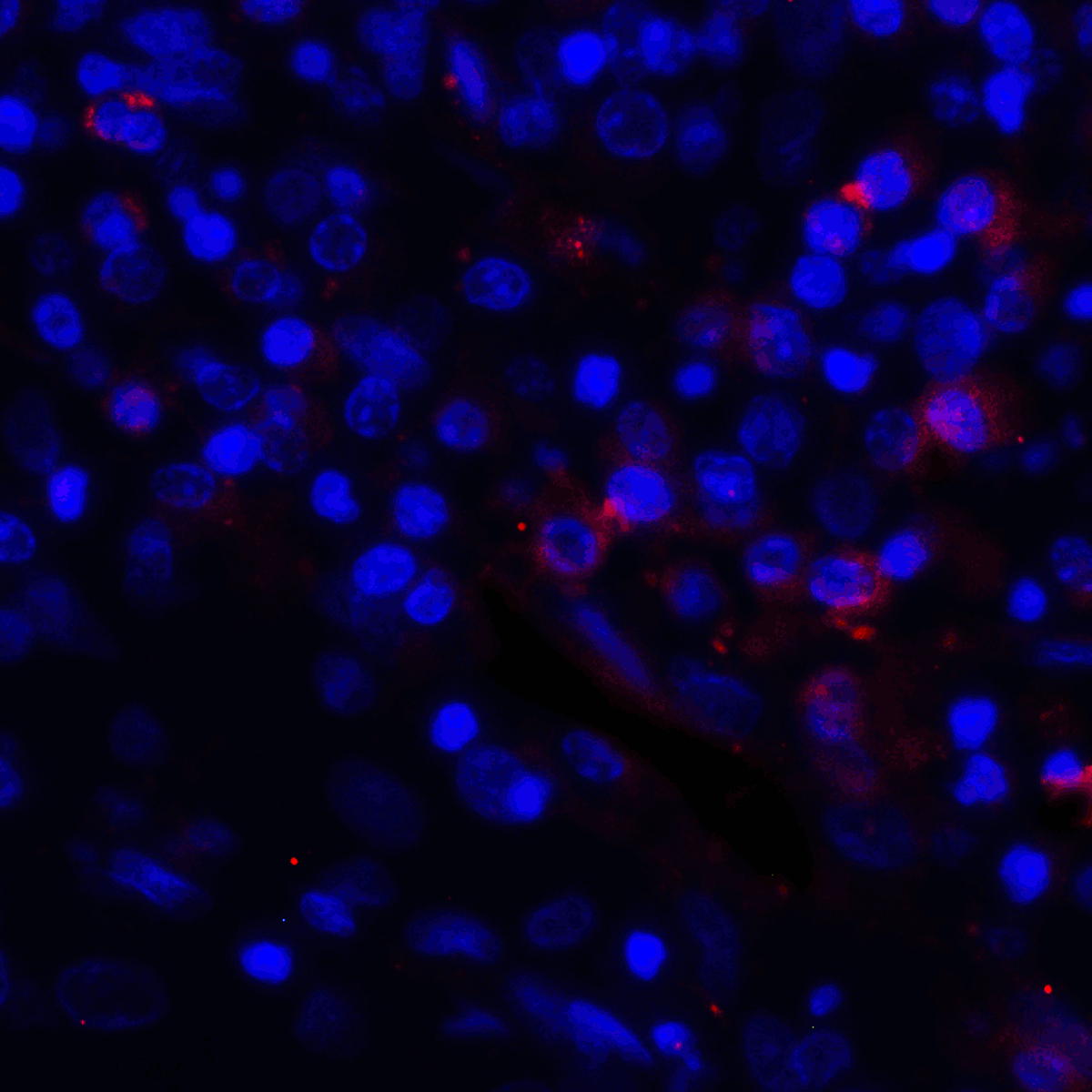 Monoclonal Mouse anti-Human CD274 / B7-H1 / PD-L1 Antibody (clone 4F2, IHC, IF, WB)