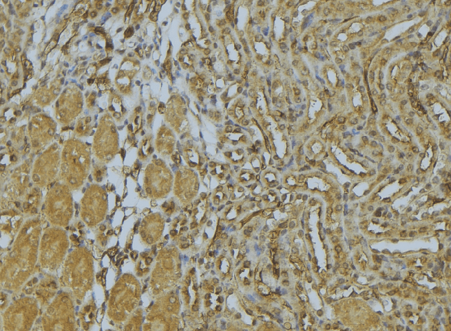 AP1M1 Antibody