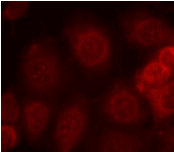 Polyclonal Rabbit anti-Human PTEN Antibody (IHC, IF, WB)