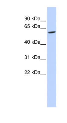 Polyclonal Rabbit anti-Human FAM134C Antibody (aa36-85, WB)