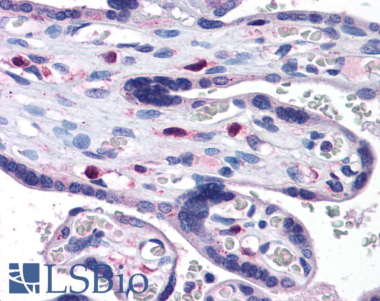 IHC-plus™ SNX16 Antibody (aa2-14)