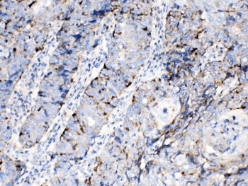 BAX Antibody