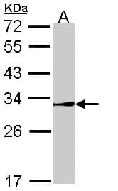 NR0B2 Antibody (aa64-257)