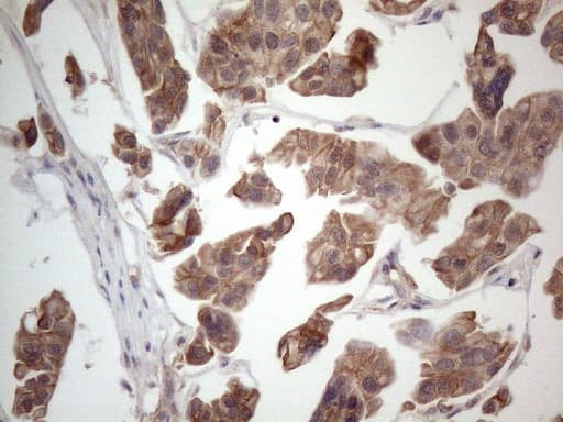 Monoclonal Mouse anti-Human MTF-1 Antibody (clone OTI2F3, aa1-272, IHC, WB)