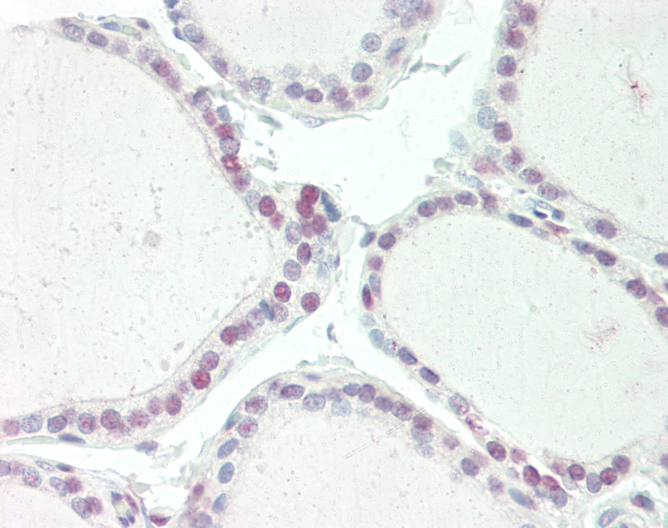Polyclonal Rabbit anti-Human CNOT3 Antibody (C-Terminus, IHC, WB)