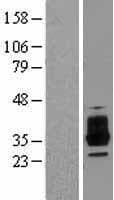 OSCAR Protein (Over-Expression Lysate Myc-DDK (Flag))