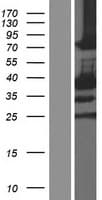 SCML1 Protein (Over-Expression Lysate Myc-DDK (Flag))