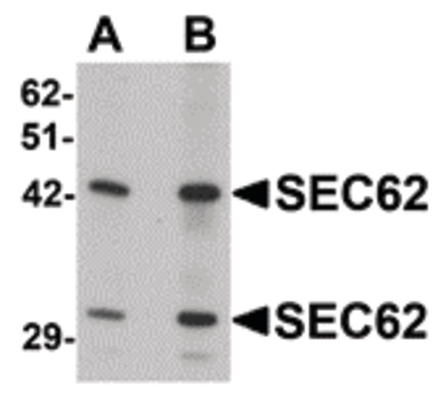 IHC-plus™ SEC62 / TP-1 Antibody